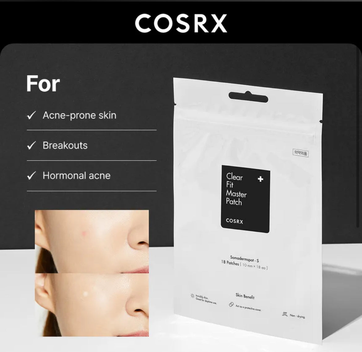 COSRX- parche para brote